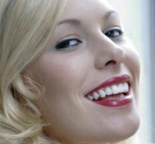 Excellent Smile